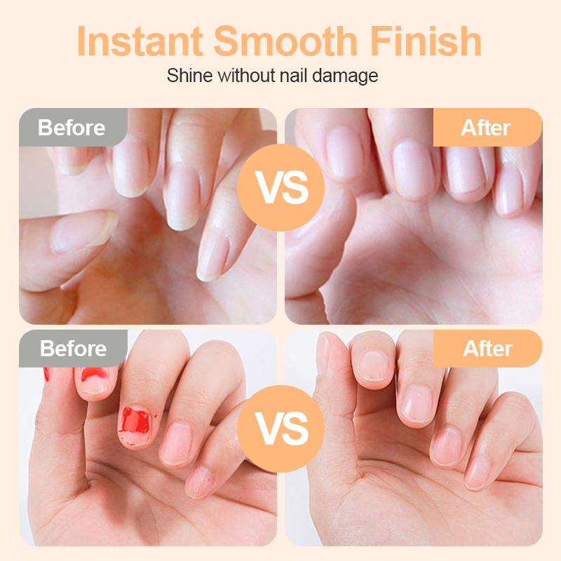 π₯2-in-1 Smart Electric Nail Trimmer & Polisher for All Ages π¨βπ©βπ§βπ¦ β Blade-Free, Blood-Free & Stress-Free Nail Care! π