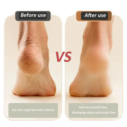 🔥Limited Time 50% OFF🔥2024 New USB rechargeable foot repair and grinding device