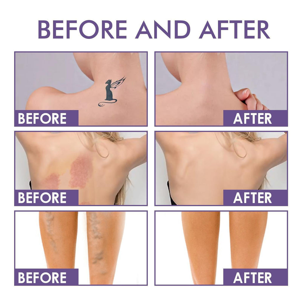 💜Body Coverage Perfector – Waterproof, Lightweight & Flawless Body Makeup