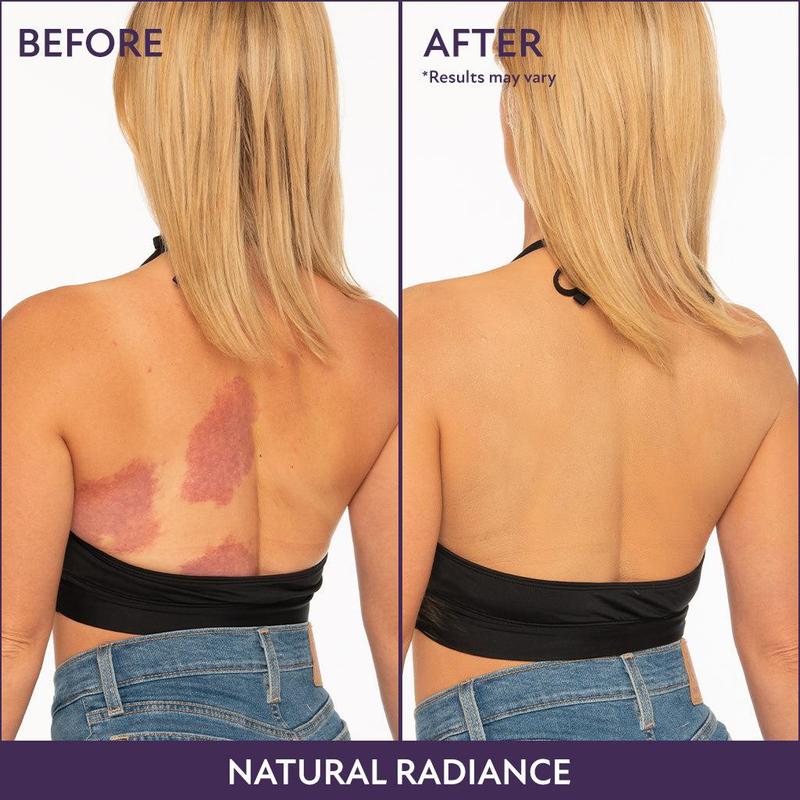 💜Body Coverage Perfector – Waterproof, Lightweight & Flawless Body Makeup