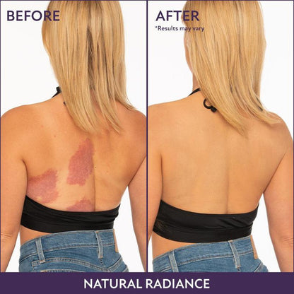 💜Body Coverage Perfector – Waterproof, Lightweight & Flawless Body Makeup